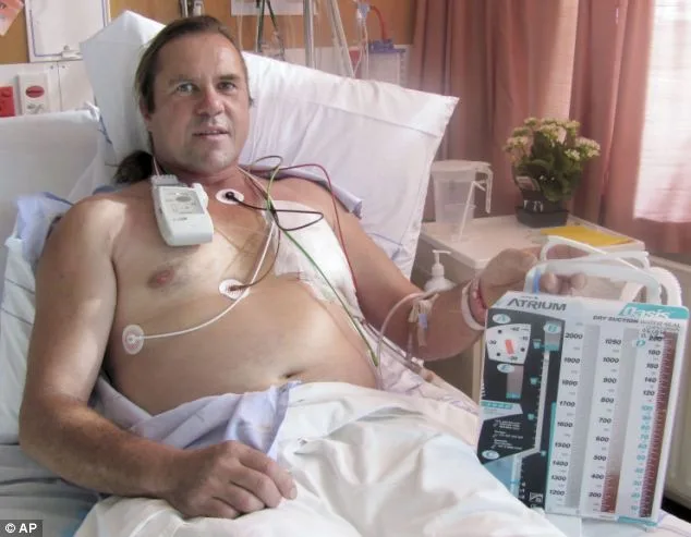 New Zealand Man Survives Bizarre Air Hose Accident